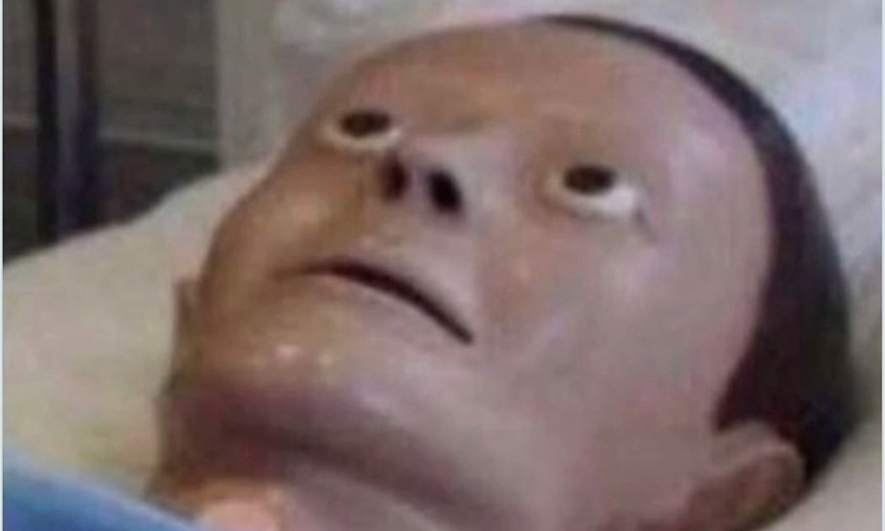 O Melhor do X – “Morrissey com Sono” edition